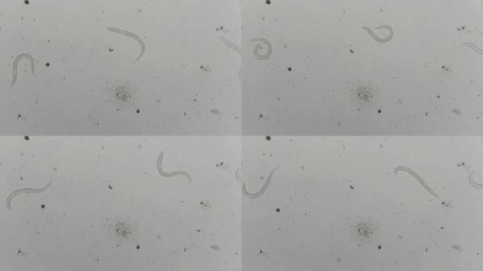 寄生虫：斯特氏拟杆菌