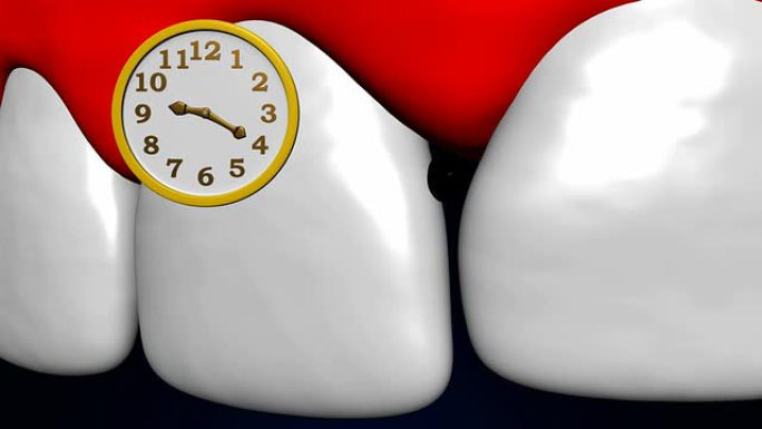 龋齿的研究进展转动时钟牙齿三维构造图