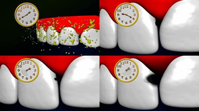 龋齿的研究进展转动时钟牙齿三维构造图