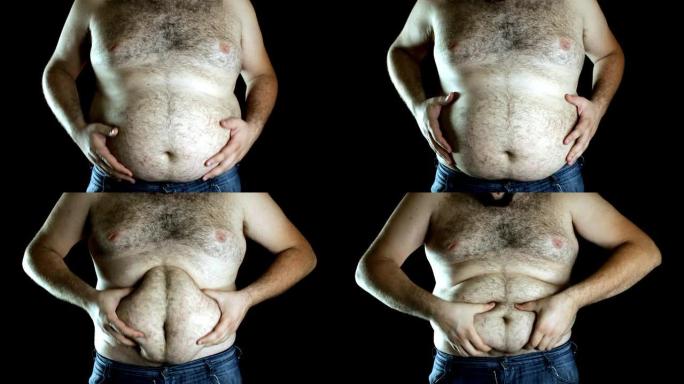 超重男子露出肚子肥胖症脂肪堆积大肚腩特写