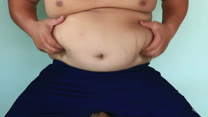 肥腹和肚脐肥腹和肚脐肥胖