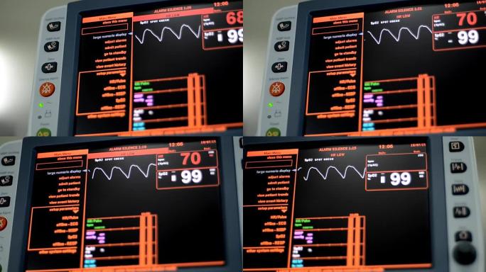 生命体征监测仪心电图心率心脏跳动生命体征