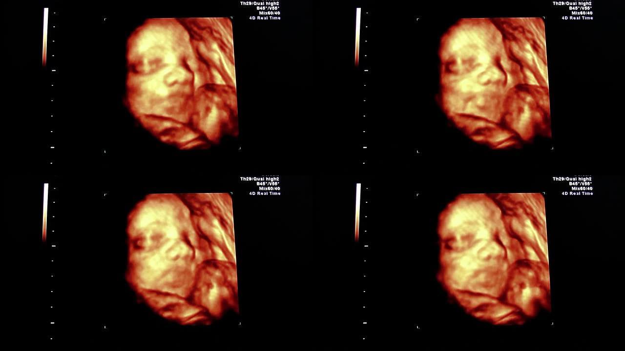 超声波三维超声波三维孕妇怀孕胎儿