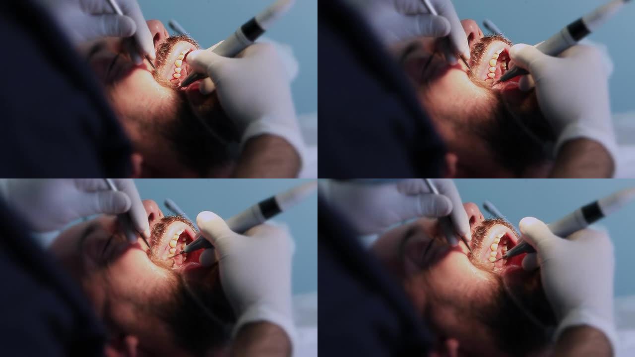 牙科治疗牙科医生洗牙牙齿患者