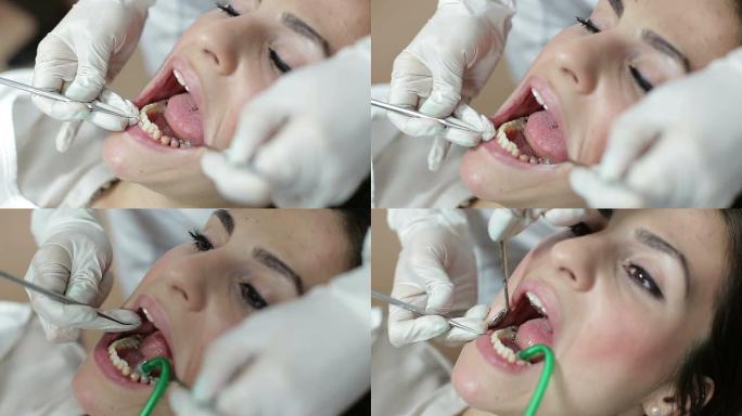 修补病人的牙齿