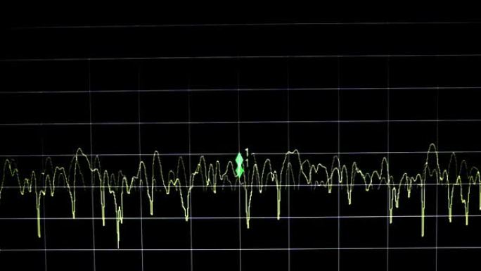 电子波信号波段心电图生命线