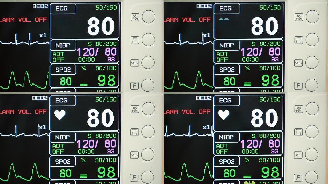 ICU心脏监测仪（HD）