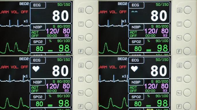 ICU心脏监测仪（HD）