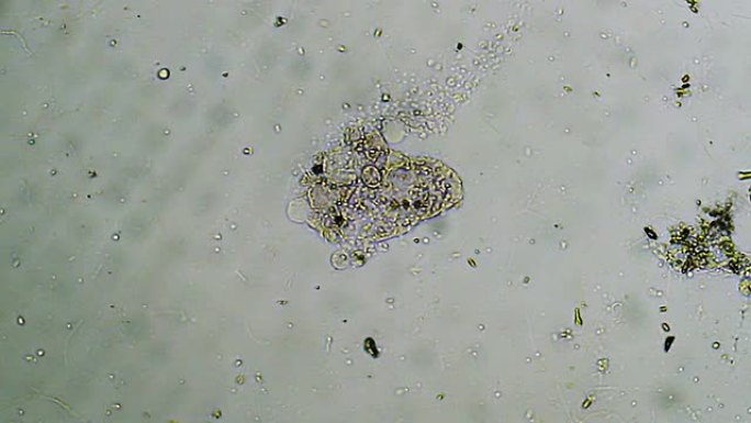 微生物死亡微生物死亡显微镜