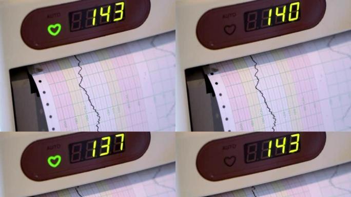 NTSC：心率监测器（视频）
