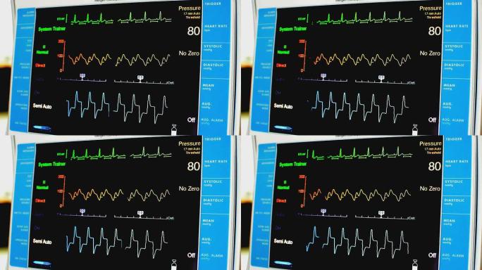 生命体征监测仪心电图心率心脏死亡生命体征