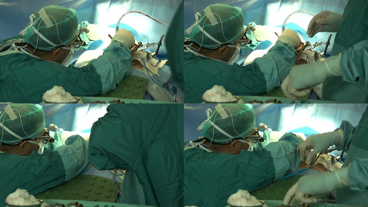 外科医生操作病人的心脏