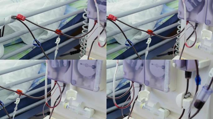 工作人工肾输血患者输血输血设备