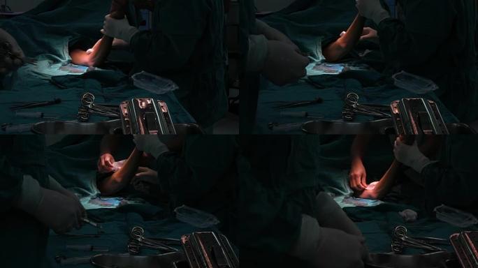 手术结束后，助理外科医生关闭了手术伤口