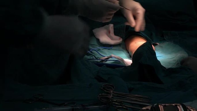 血管外科医生注射局部麻醉并切开