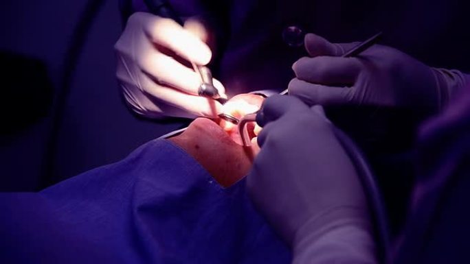 牙齿抛光牙齿牙齿抛光牙齿手术室牙科