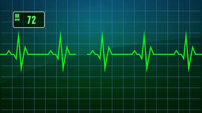 心电图（EKG或ECG）回路