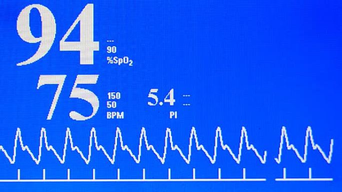脉冲跟踪心电图心率心脏跳动生命体征监测仪