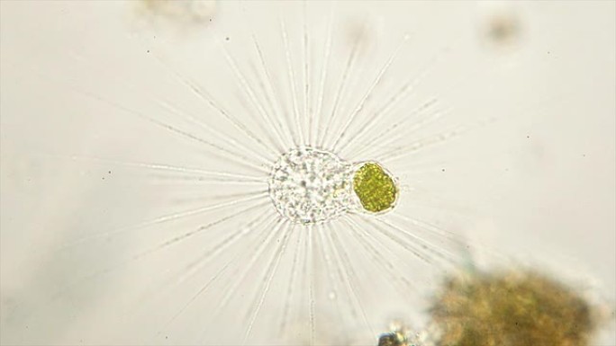 太阳微生物，放线菌种类，显微照片