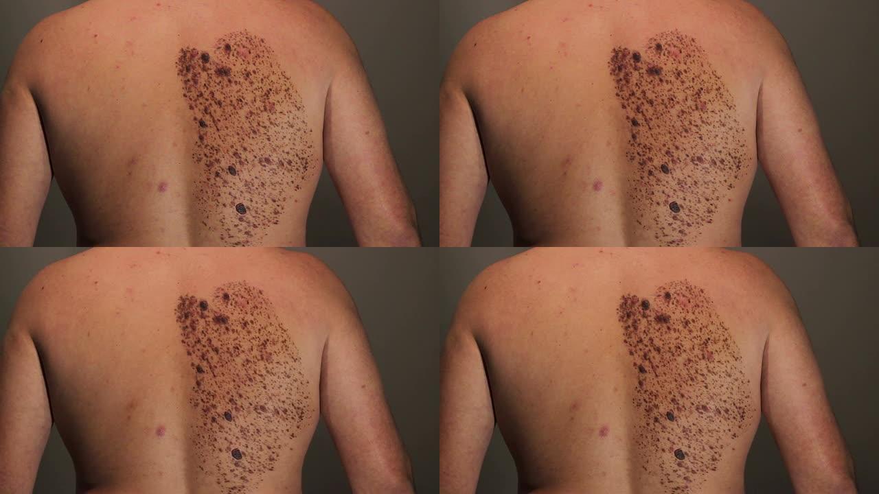 不寻常的景点皮肤问题皮肤病抓痒湿疹荨麻疹