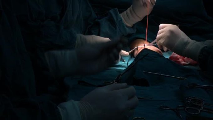 血管外科医生确定了头静脉和radial动脉