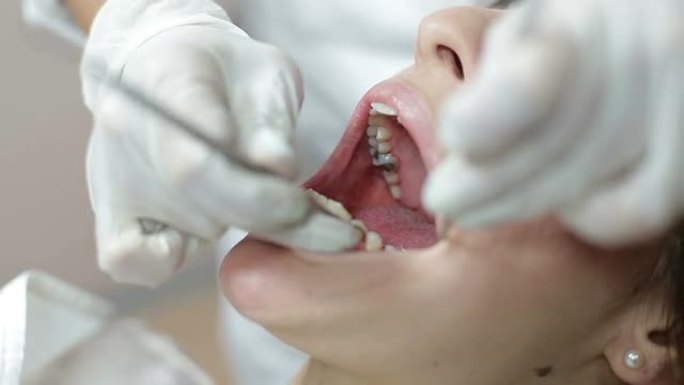 修补病人的牙齿治疗修牙牙疼