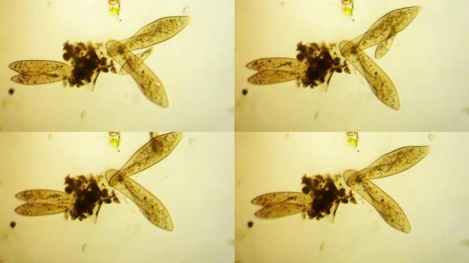 尾状草履虫显微照片