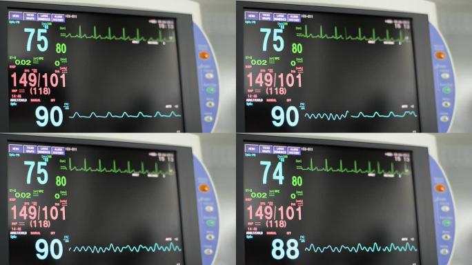 生命体征监测仪心电图心率心脏跳动生命体征