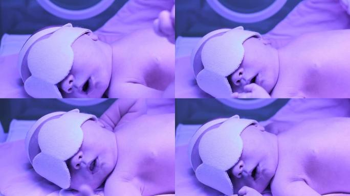 婴儿辐射照蓝光照黄疸早产儿