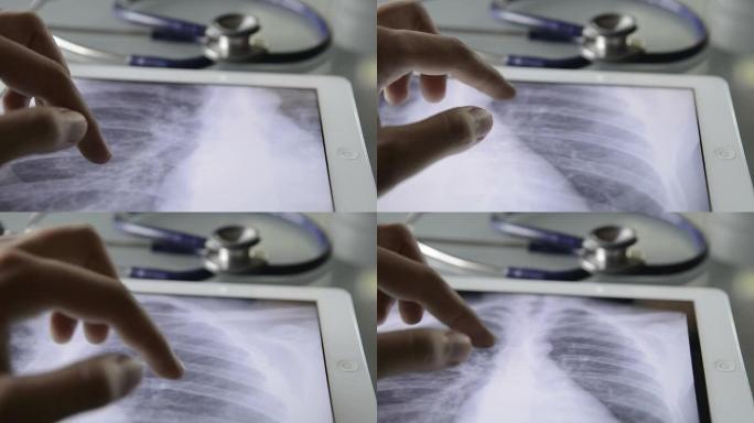 医生检查平板电脑上的X射线图像