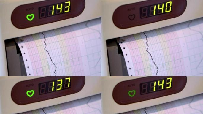 PAL：心率监测器（视频）