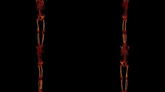 下肢多探测器CT血管造影
