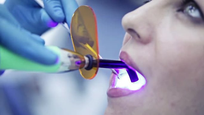牙科治疗紫外线设备