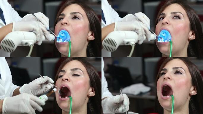 紫外光固化干燥嵌体