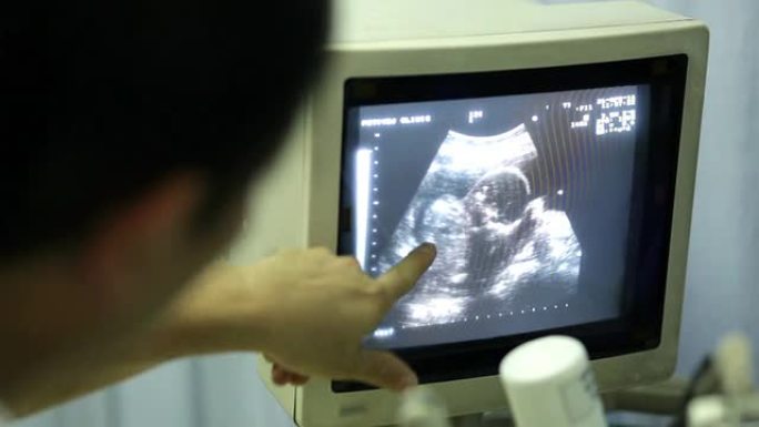 产前超声和胎儿监测