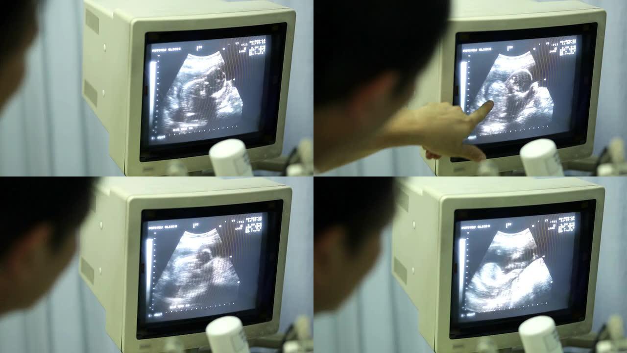 产前超声和胎儿监测