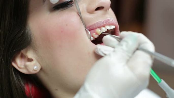 修补病人的牙齿牙科医生医院拔牙种牙洗牙