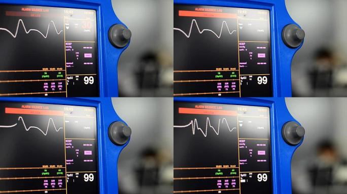 病人监护仪检测