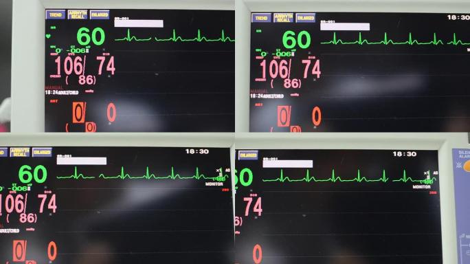 生命体征监测仪生命体征监测仪心电图死亡