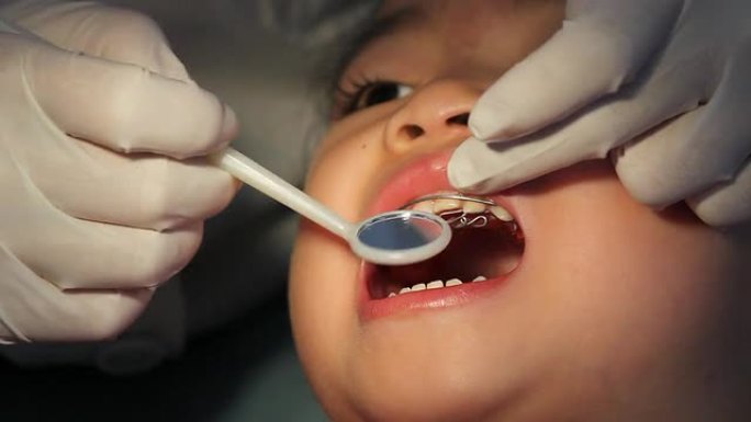 牙医小心翼翼地反复为亚洲恐慌症婴儿调整牙套。