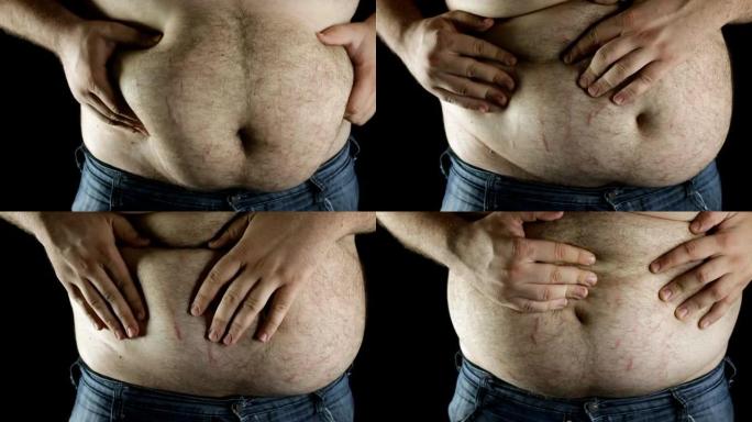 超重男子露出肚子超重男子露出肚子肥胖