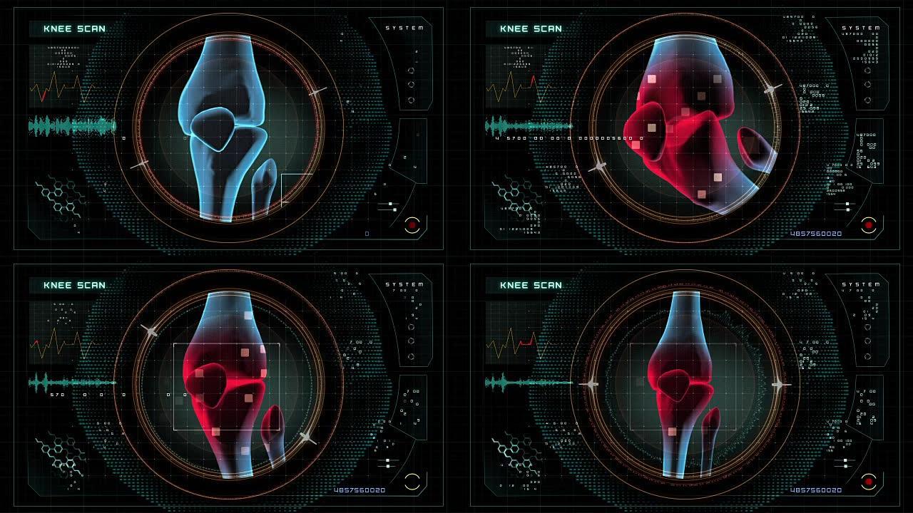 膝盖扫描数据接口。