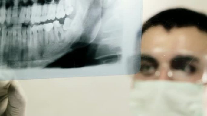 X射线扫描牙科医生看片子牙齿