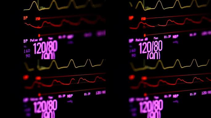 血压监测仪血压监测仪心电图