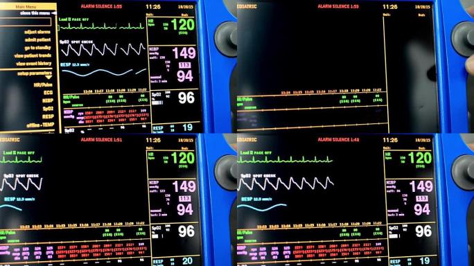 生命体征监测仪心跳监控仪器心电图实时监控