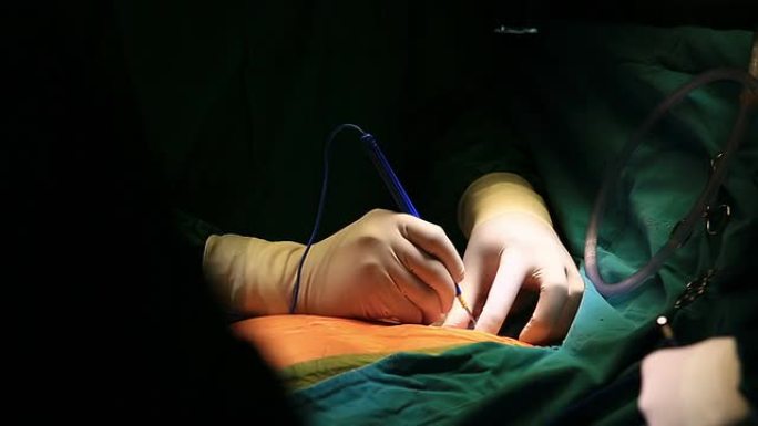 正中胸骨切开术在心脏直视手术中的应用