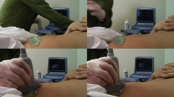 超声检查确定妊娠比超医学检查医学设备