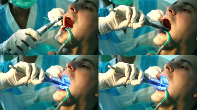 牙科治疗。牙科医生外国人男子治疗牙齿国外