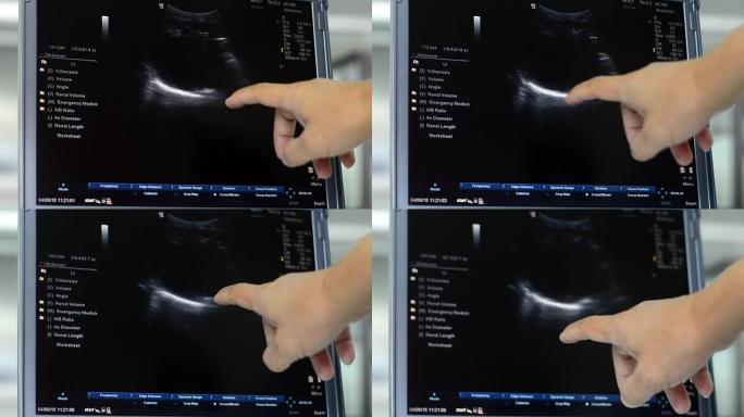 超声精准生育护理超声波检查技术健康监测设