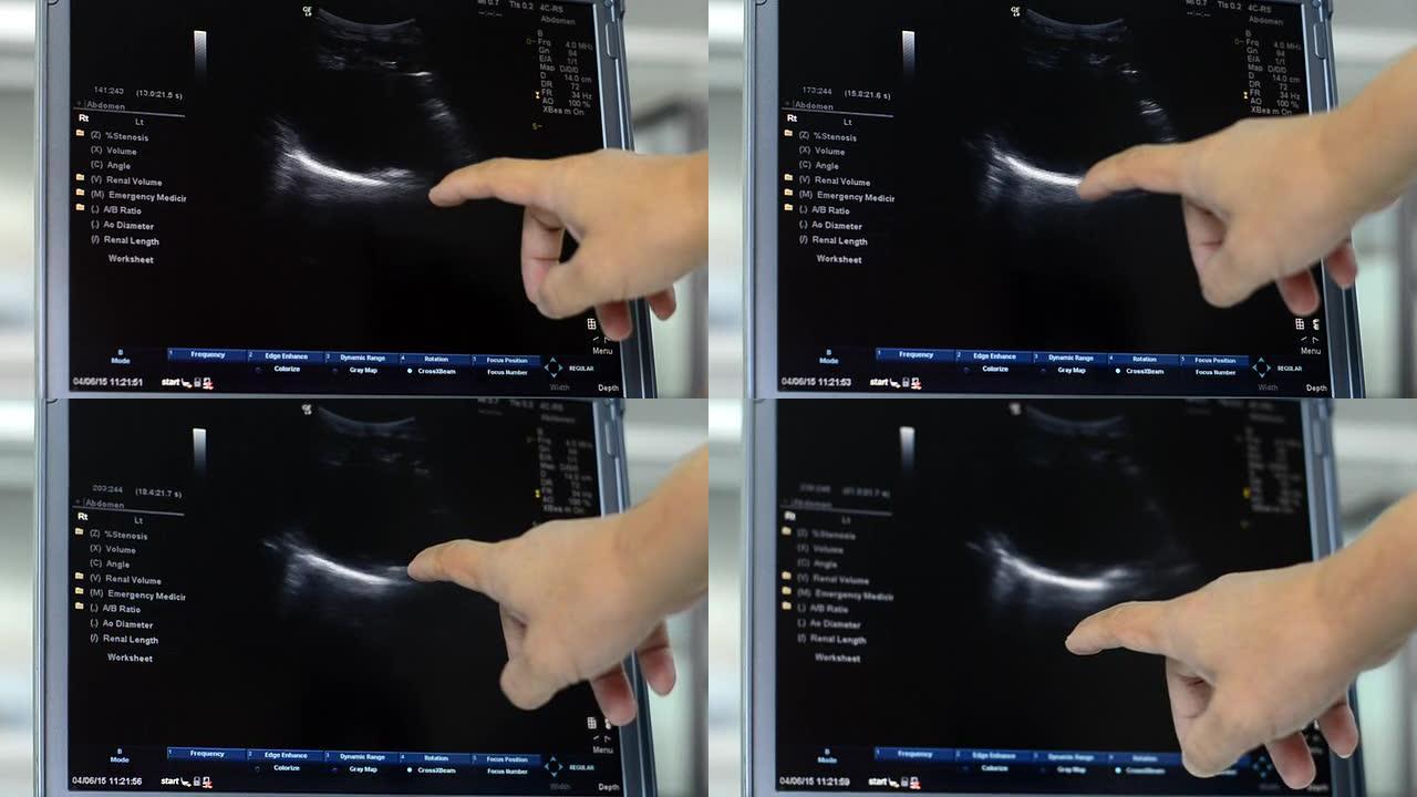 超声精准生育护理超声波检查技术健康监测设